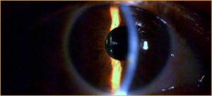 Última Dica em Saúde de 2024 publicada na BVSMS é sobre “Vista Cansada” (Presbiopia)